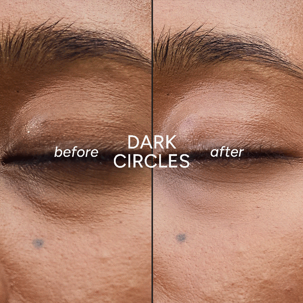 before / after images of dark circles, eye bags and fine lines and wrinkles, of using In My Eyes eye mask / eye patches