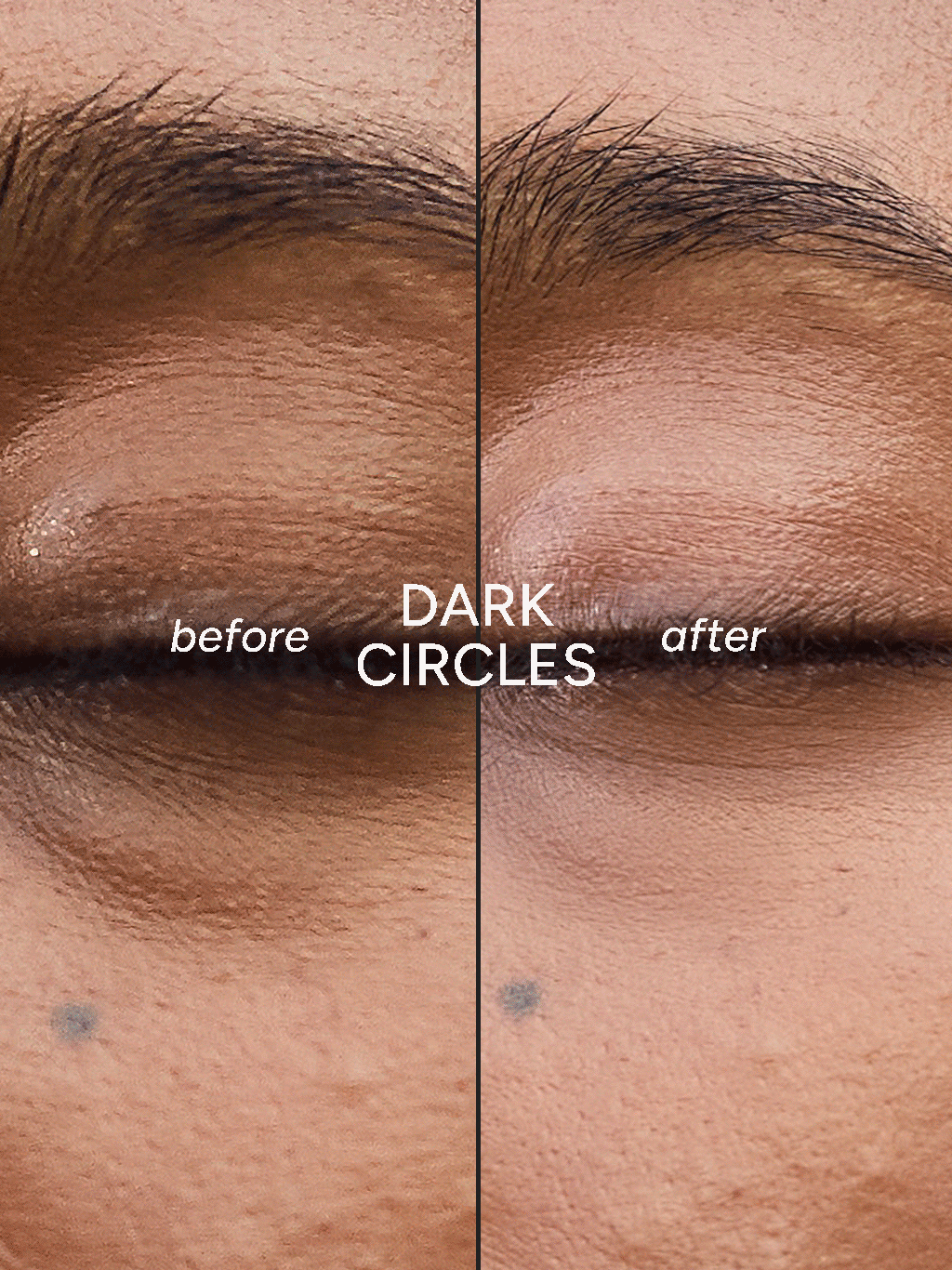 (peekaboo) Ever-Hydrating Eye Patches